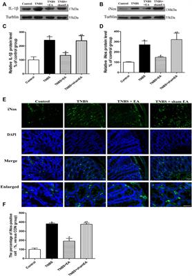 Electroacupuncture Reduces Visceral Pain Via Cannabinoid CB2 Receptors in a Mouse Model of Inflammatory Bowel Disease